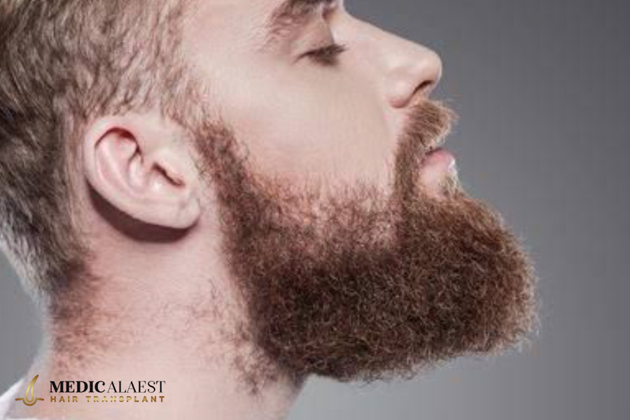 Medicalaest - BEARD HAIR TRANSPLANT
