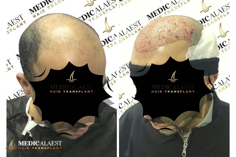 Medicalaest - BEFORE & AFTER GALLERY