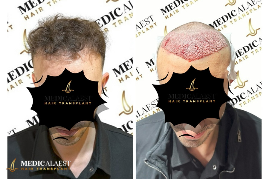 Medicalaest - BEFORE & AFTER GALLERY