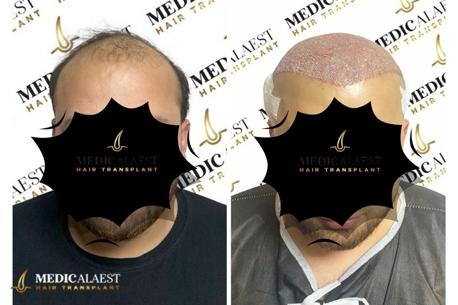 Medicalaest - BEFORE & AFTER GALLERY