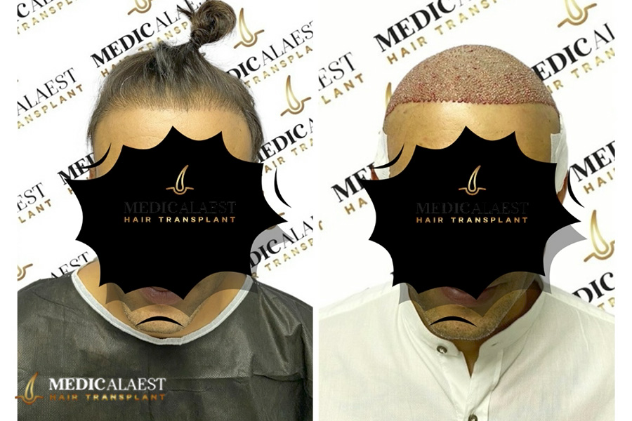 Medicalaest - BEFORE & AFTER GALLERY