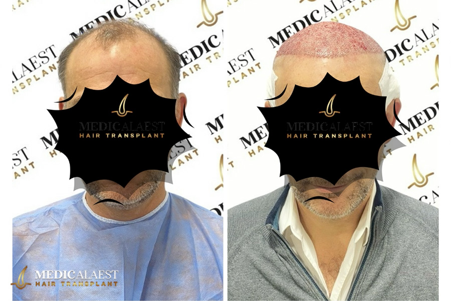 Medicalaest - BEFORE & AFTER GALLERY