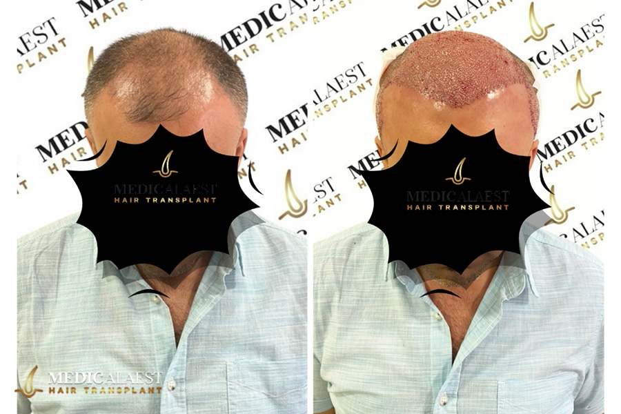 Medicalaest - BEFORE & AFTER GALLERY