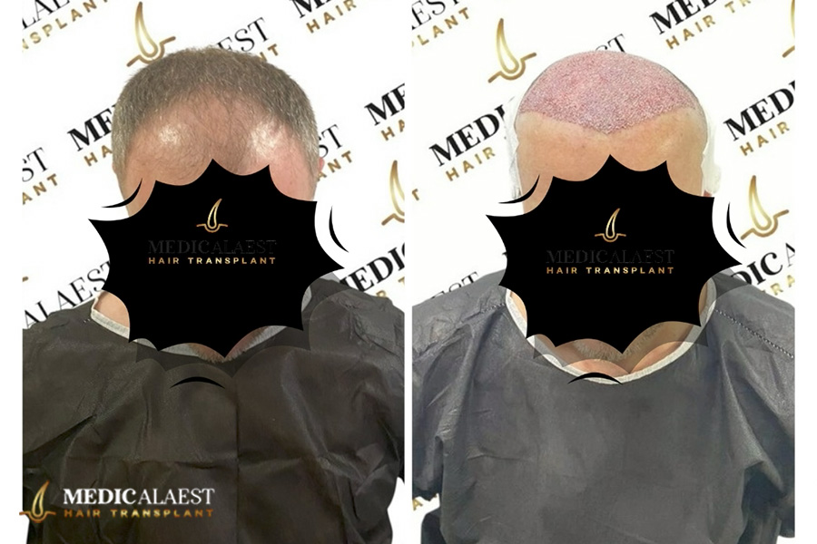 Medicalaest - BEFORE & AFTER GALLERY