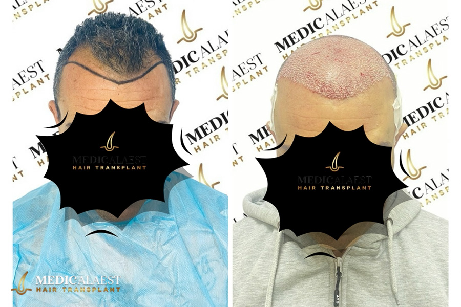 Medicalaest - BEFORE & AFTER GALLERY