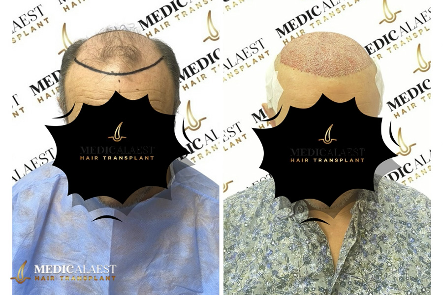 Medicalaest - BEFORE & AFTER GALLERY