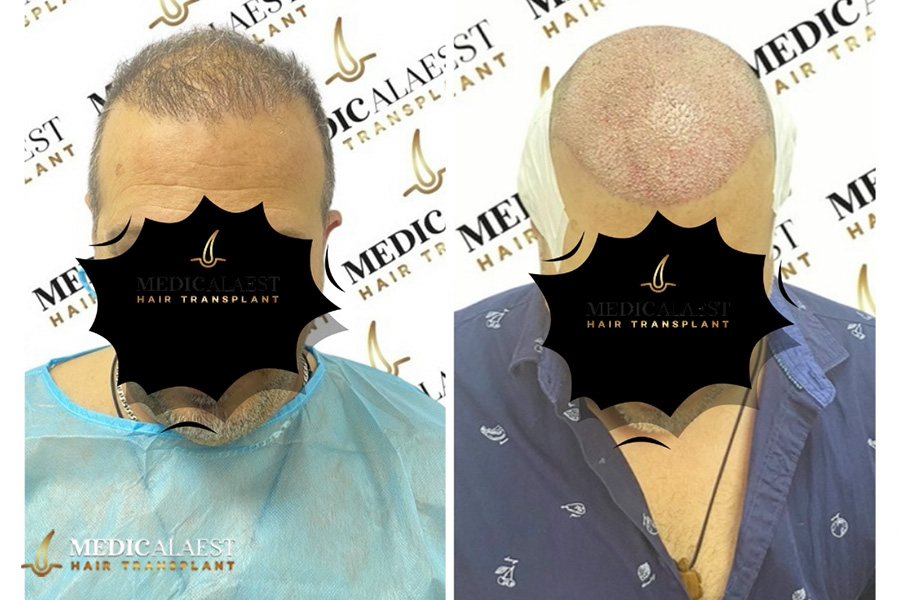 Medicalaest - BEFORE & AFTER GALLERY