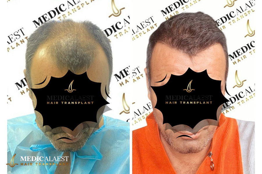 Medicalaest - BEFORE & AFTER GALLERY