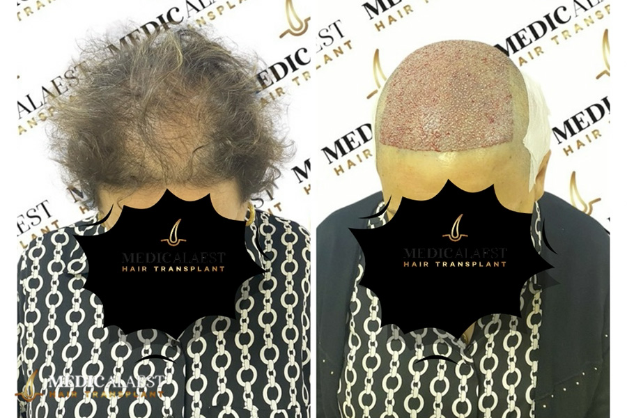 Medicalaest - BEFORE & AFTER GALLERY