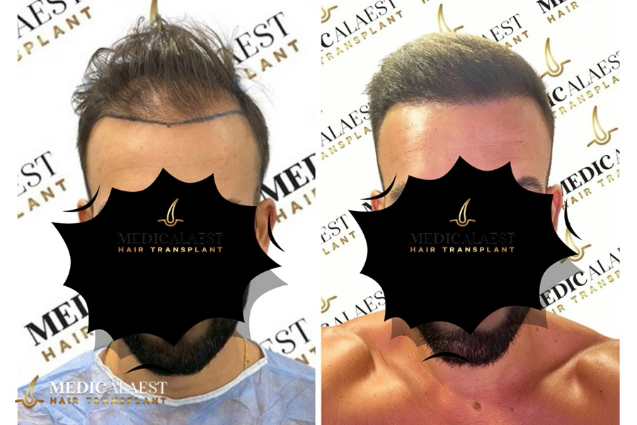 Medicalaest - BEFORE & AFTER GALLERY