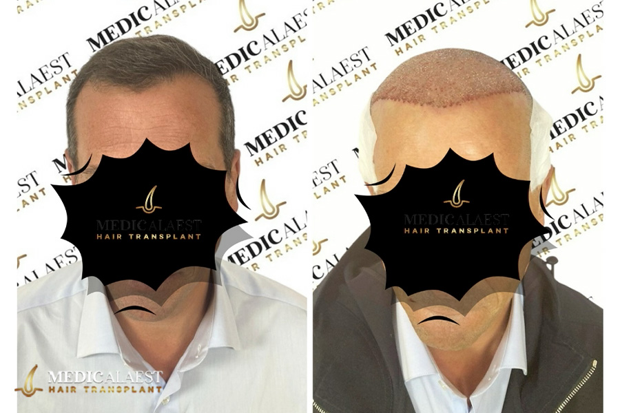 Medicalaest - BEFORE & AFTER GALLERY