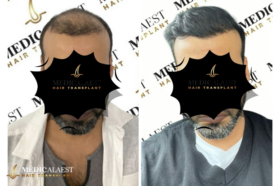 Medicalaest - BEFORE & AFTER GALLERY