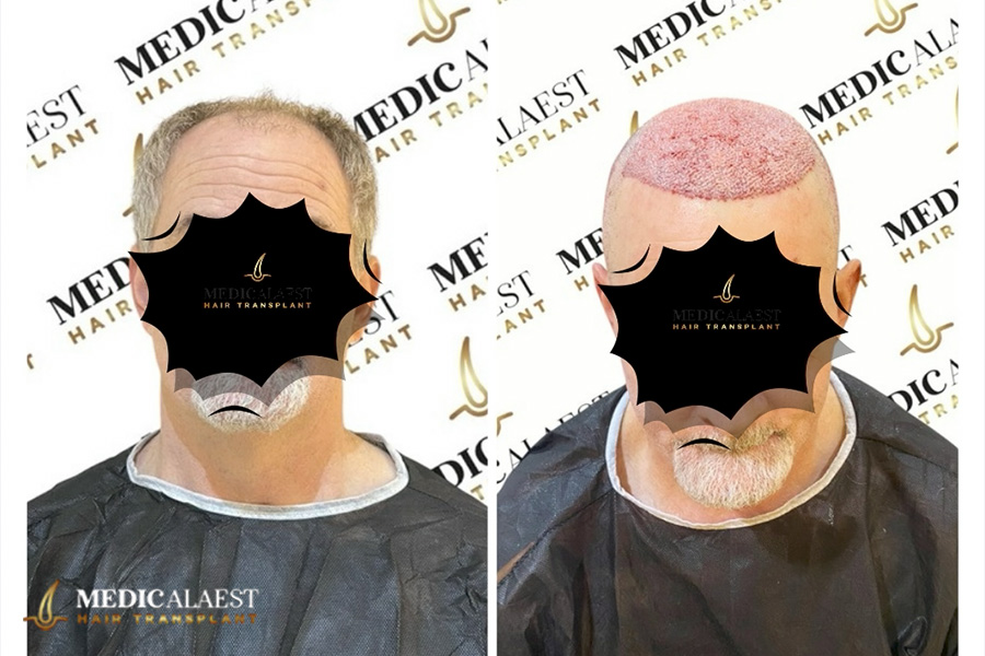 Medicalaest - BEFORE & AFTER GALLERY